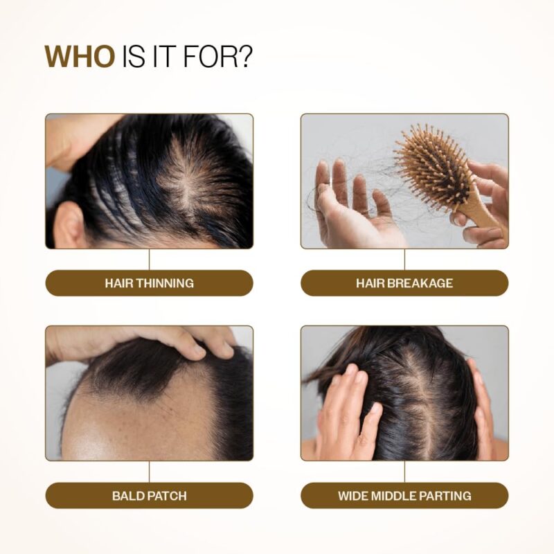 Buy Bare Anatomy Hair Growth Serum in Nepal at Beautix Nepal. Redensyl-powered formula for thicker, healthier-looking hair. Fast delivery.